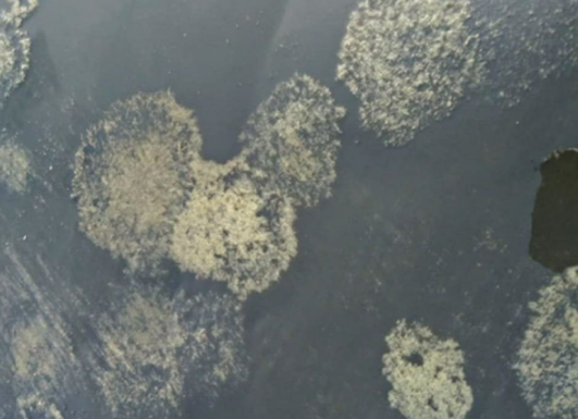 Chia sẻ: Nấm đồng tiền: Nguyên nhân tái nhiễm dù đã điều trị đúng cách